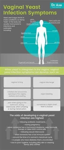 Infecção Vaginal levedura sintomas - Dr. Machado