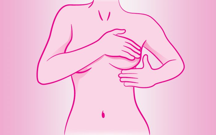 Câncer de Mama: tudo que você precisa saber