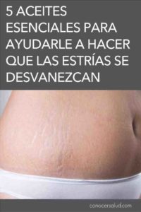 5 óleos essenciais para ajudá-lo a fazer com que as estrias se despedacem