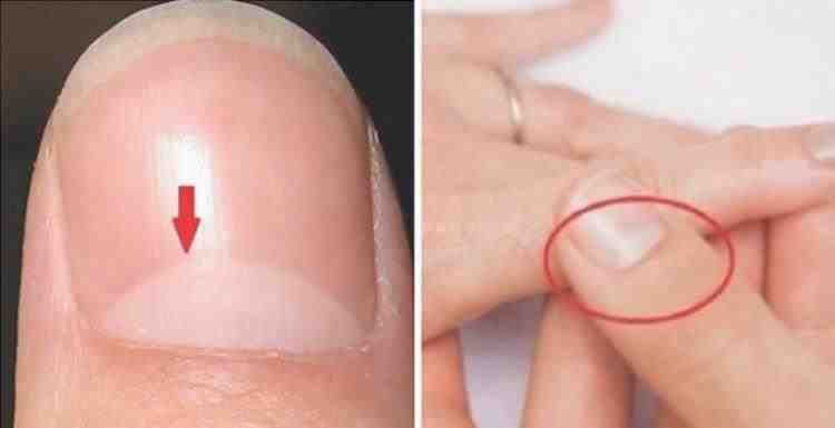 Unhas