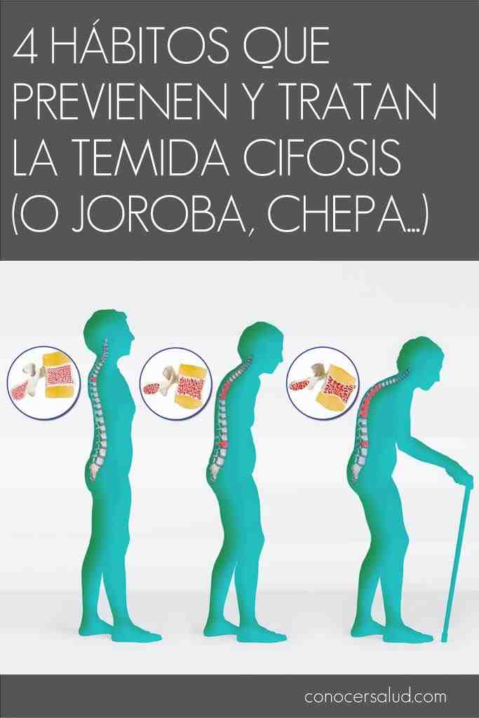 4 hábitos que previnem e tratam a temida cifose (corcunda) 4 hábitos que previnem e tratam a temida cifose (corcunda)