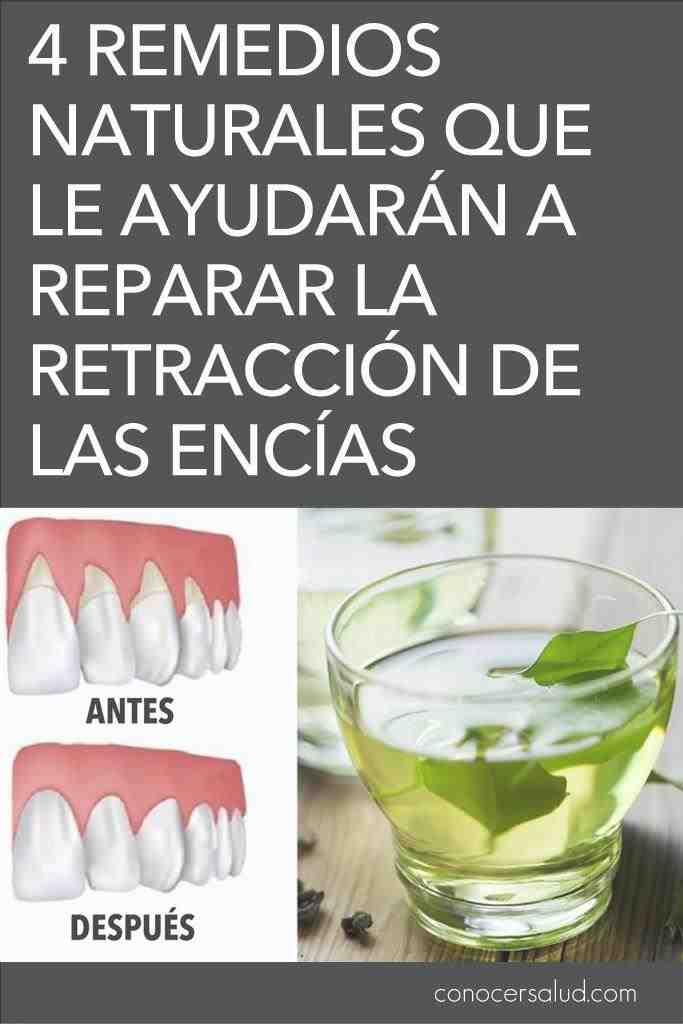remedios naturales retraccion encias pinterest
