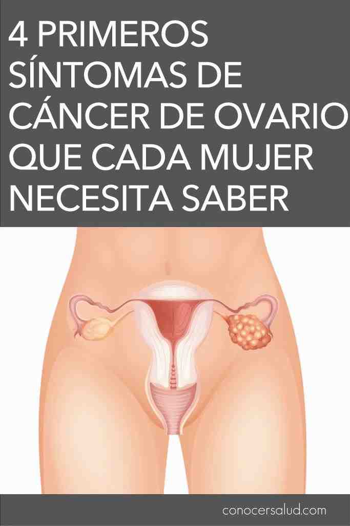 4 primeiros sintomas de câncer de ovário. Toda mulher precisa saber!